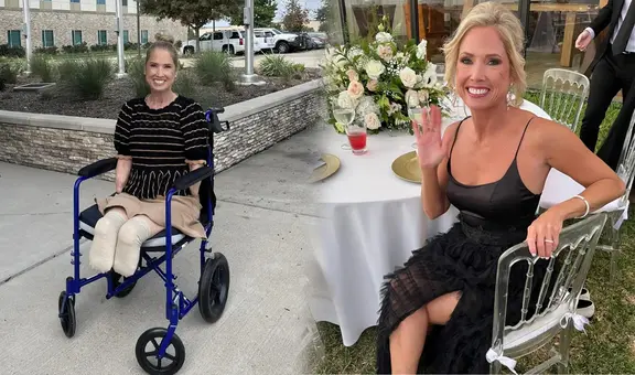 Maestra de secundaria fue al hospital creyendo que tenía un resfriado y tuvieron que amputarle todas las extremidades en Texas