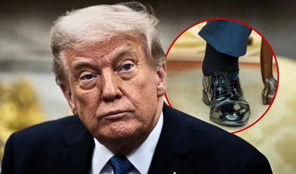 ¿Qué es la insuficiencia venosa crónica que afecta a Donald Trump y por qué es tan común en personas mayores con sobrepeso?