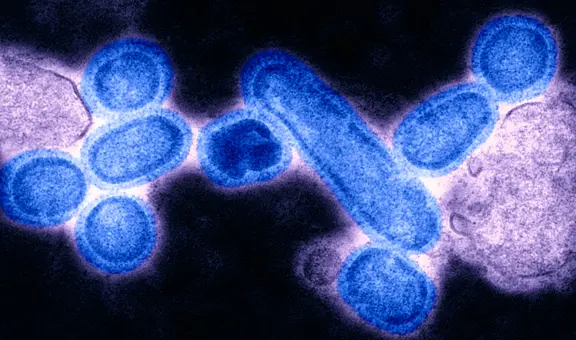 Científicos resucitaron el virus de la “gripe española” de hace casi 100 años y descubren algo aterrador: ya había mutado para evadir nuestros cuerpos