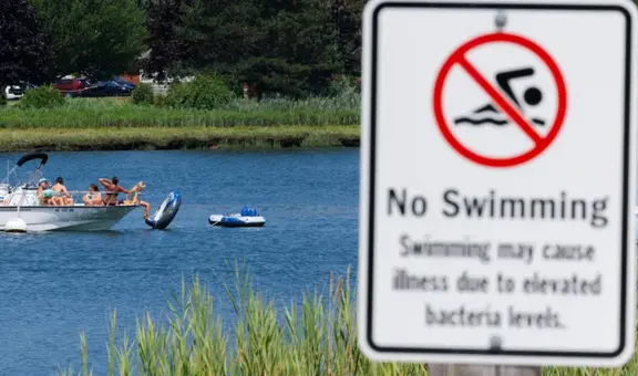 Menor muere tras contraer una ameba 'comecerebros' después de nadar en un lago de Estados Unidos