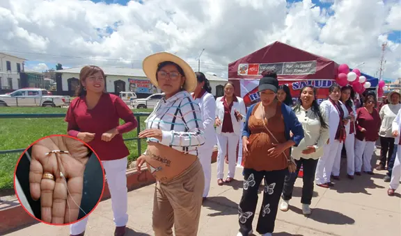 Minsa realizará campaña gratuita de salud sexual y planificación familiar en Gamarra este 2 de agosto