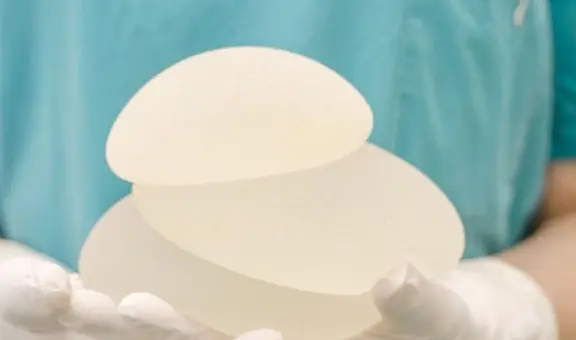 Alerta internacional por implantes médicos prohibidos en Brasil: Digemid continúa evaluando uso de productos en Perú