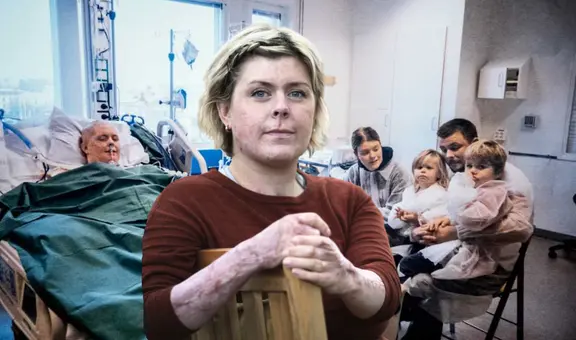 El heroico acto de Emma Schols, la madre que sufrió quemaduras en el 93% de su cuerpo para salvar la vida de sus seis hijos en Suecia