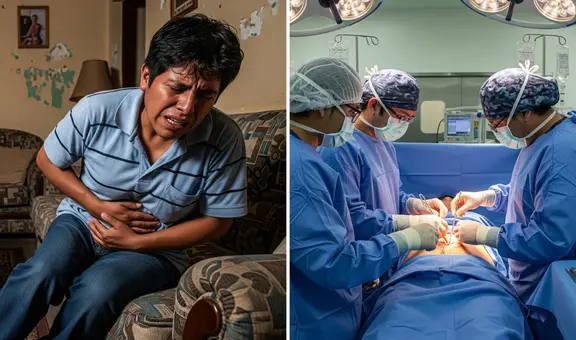 ¿Por qué los peruanos dicen que el apéndice no sirve? Especialista explica el motivo para extraer este órgano y cómo es la operación