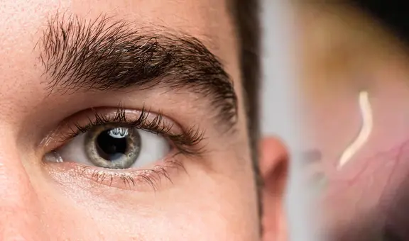 Médicos en India extraen de un ojo humano un parásito común en perros y gatos: el hombre sufría inflamación ocular