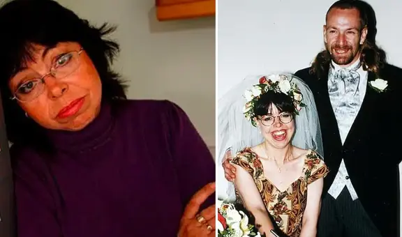 Michelle Philpots, la mujer de Inglaterra que tras un accidente de auto pierde la memoria al dormirse: la estrategia de su esposo para recordarle su matrimonio