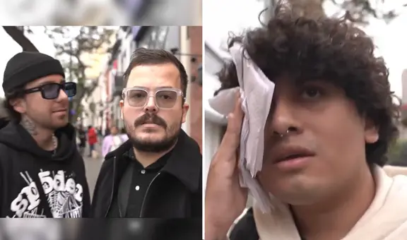 Youtuber Roberto Artigas y su equipo fueron agredidos por sujeto en Miraflores: camarógrafo terminó con un corte en la ceja