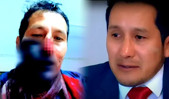 Empresario abatió en defensa propia a sujeto que lo golpeó y le robó S/9.000, pero podría ir preso 15 años: "Era mi vida o la del delincuente"