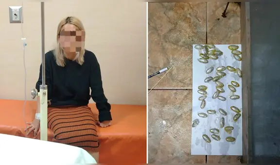 Arequipa: mujer intentó ingresar al penal con droga en el estómago