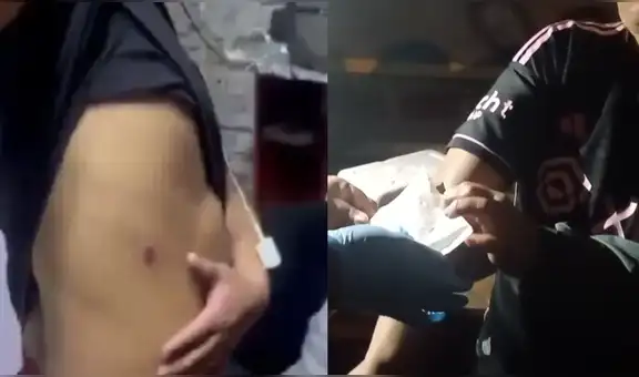 "Me persiguieron y apuntaron": joven relató cómo la PNP entró disparando a Comunidad Cantagallo