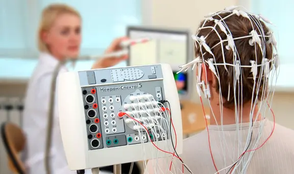 Nueva herramienta de inteligencia artificial ayuda a localizar lesiones en niños con epilepsia