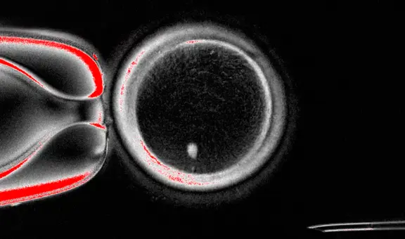 Avance frente a la infertilidad: científicos crearon los primeros óvulos humanos fecundables a partir de células de la piel