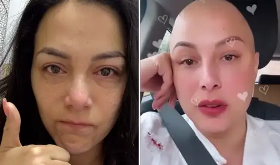 Natalia Salas revela cómo reaccionó a la dura noticia de que el cáncer volvió: “Me asuste al inicio"