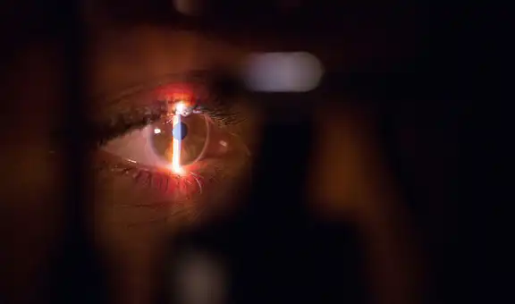 Científicos crean una prótesis ocular que devuelve la visión a personas con ceguera irreversible