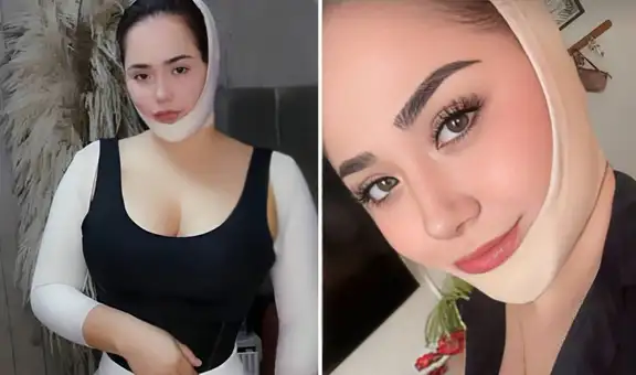 Ana Lucía Urbina de Corazón Serrano cuenta todos los detalles de su operación en el rostro y cuerpo