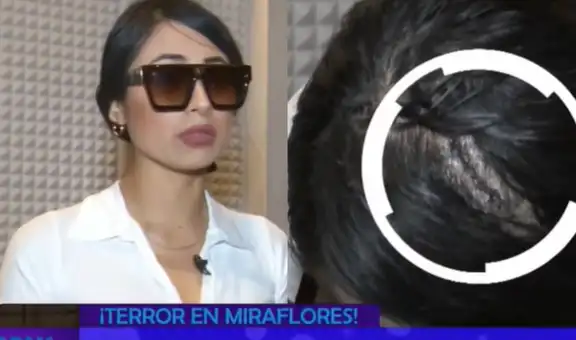 Bárbara Cam, exMiss Perú Áncash, denuncia brutal agresión en conocida discoteca: le rompieron la cabeza y tuvieron que ponerle varios puntos