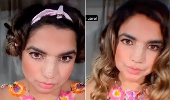 Susana Alvarado muestra su cirugía nasal: integrante de Corazón Serrano se operó por motivos de salud