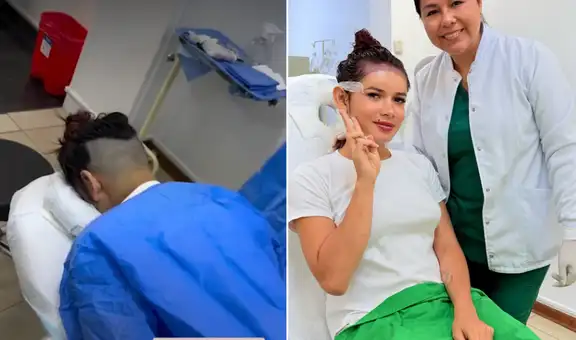 La ‘Uchulú’ sorprende al someterse a cirugía de trasplante de cabello y presume su nueva imagen: “Una nueva versión de mí”