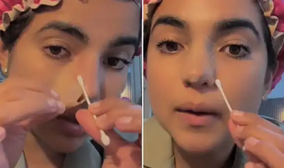 Susana Alvarado de Corazón Serrano muestra cómo luce su renovada nariz y enseña paso a paso su cuidado postoperatorio: "Va excelente"