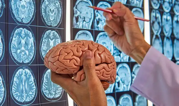 Los científicos revelan el test rápido capaz de detectar el Alzheimer mucho antes de los síntomas