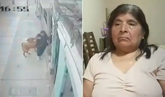 Adulta mayor resulta herida tras brutal ataque de dos perros en La Victoria: "No puedo dormir"