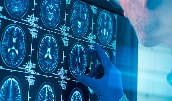 No es en la adolescencia: científicos revelan la edad en que el cerebro llega a la madurez y cuándo empieza a envejecer