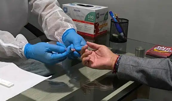 Suben los casos de VIH en Cusco: Geresa reporta 193 nuevos infectados y alerta contagio en población joven masculina