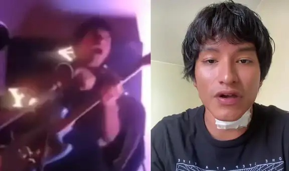 Cantante peruano sufre descarga eléctrica durante concierto en Centro de Lima y revela cómo sobrevivió al incidente: "Tengo quemaduras"