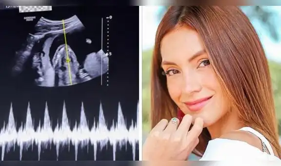 Exchica reality y modelo, Darlene Rosas, sorprende al mostrar por primera vez su embarazo de seis meses: “Nunca había amado tanto mi cuerpo”