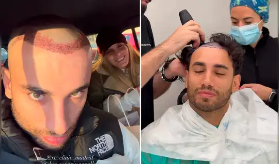 Said Palao impacta al mostrar su nueva imagen tras perder todo su cabello en tratamiento estético en España: “Esto recién empieza”
