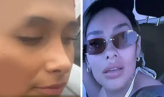 Denuncian a Shirley Arica por presunta agresión: joven muestra fotos y audio de amenazas