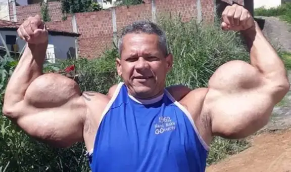 Fallece a los 55 años el ‘Popeye brasileño’, que se hizo famoso por someterse a tratamientos con aceite en los brazos para parecerse al personaje