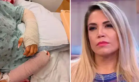 Anelhí Arias revela el difícil momento que vive por accidente de su hija con fuegos artificiales: "No es una fractura normal"