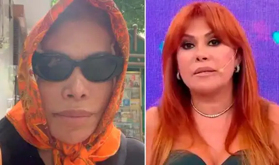 Magaly Medina no volverá a la TV hasta recuperarse de su cirugía facial: "No puedo poner a este rostro 2 kilos de maquillaje"