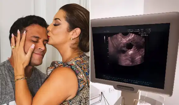 Karla Tarazona y Christian Domínguez acuden a clínica de fertilidad y sorprenden al mostrar ecografía: "Falta poco para el gran día"