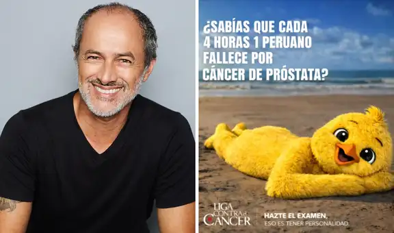 Carlos Alcántara sorprende con impactante foto por el Día Mundial contra el Cáncer y promueve el autocuidado: "Vamos muchachos a hacernos la prueba"