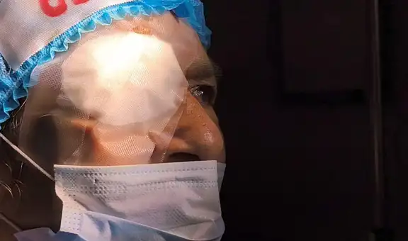 EsSalud realiza 137 cirugías de catarata en Ica para reducir lista de espera