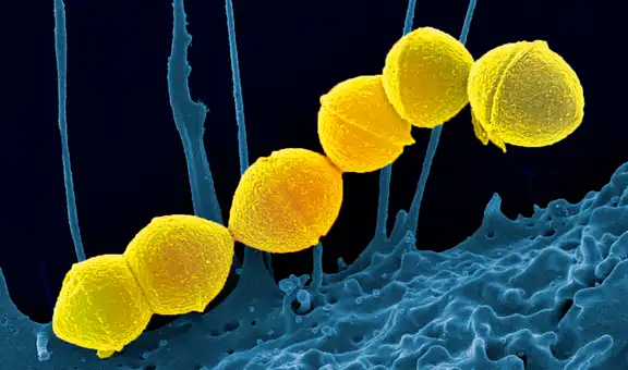Una momia prehispánica revela que la bacteria de la faringitis ya existía en América antes de la llegada de los europeos