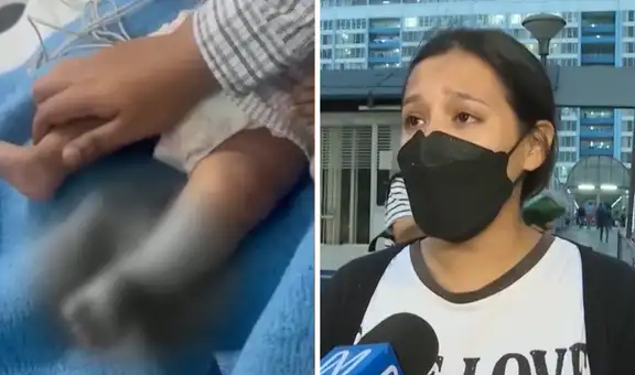 Madre denuncia que su bebé sufrió quemaduras en el Rebagliati y pide ayuda legal: “No tengo apoyo del hospital"