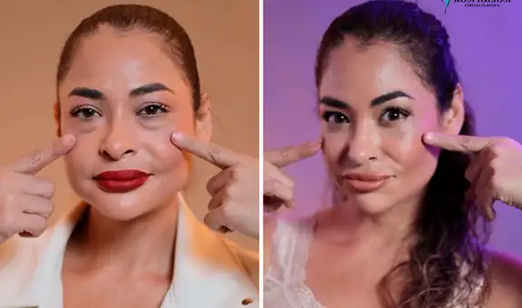 Melanie Martínez impacta al mostrar su nuevo rostro tras someterse a cirugía estética: “Gracias por devolverme la juventud”