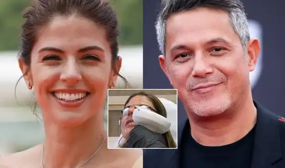 Stephanie Cayo impacta con tratamiento estético en el rostro para lucir más joven en medio de romance con Alejandro Sanz