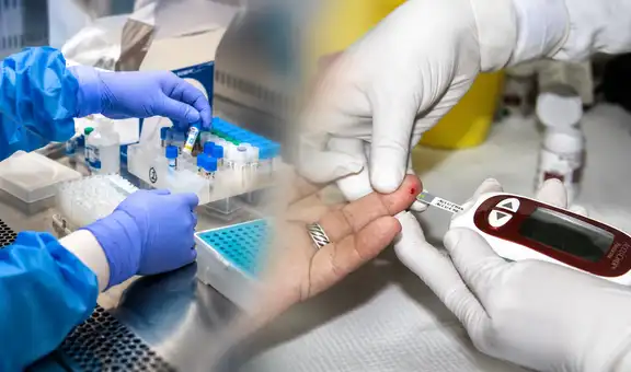 Sin costo y sin previa cita: conoce los exámenes médicos que podrás hacerte gratis en todo el Perú esta semana