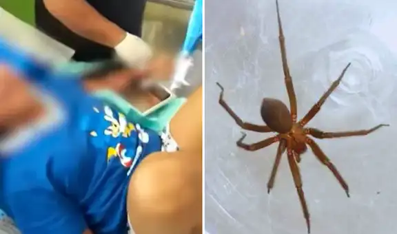 Menor fallece tras ser mordida por una araña en su vivienda: ataque le habría provocado insuficiencia renal aguda