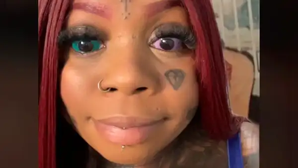 Mujer se tatuó los ojos de colores y ahora está a punto de quedarse ciega: “Fue traumático”