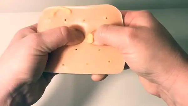 YouTube Viral: Lanzan juguete antiestrés para reventar granos llenos de pus [VIDEO]