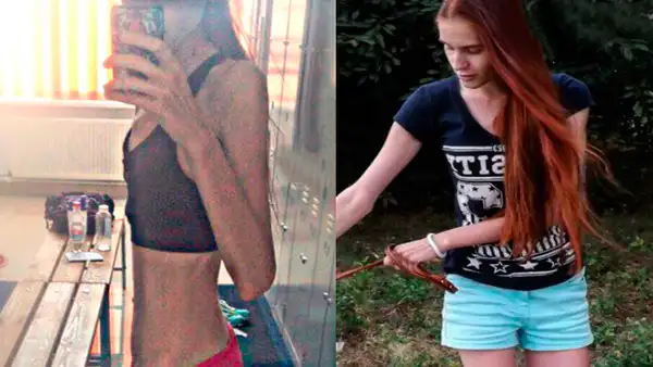 Instagram: pesaba 30 kilos por culpa de la anorexia, se recuperó y ahora luce una envidiable figura [FOTOS]