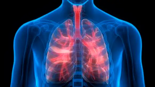 Fibrosis pulmonar: ¿Qué le sucede al órgano cuando se presenta la enfermedad?