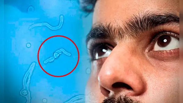 ¿Por qué sueles ver ‘gusanitos’ en tu campo visual? Esto dice la ciencia