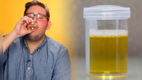 ¿Beber orina trae beneficios a la salud?