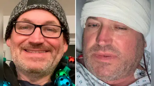 Fue al hospital con malestar, le dijeron que le había picado un insecto pero tenía cáncer terminal
